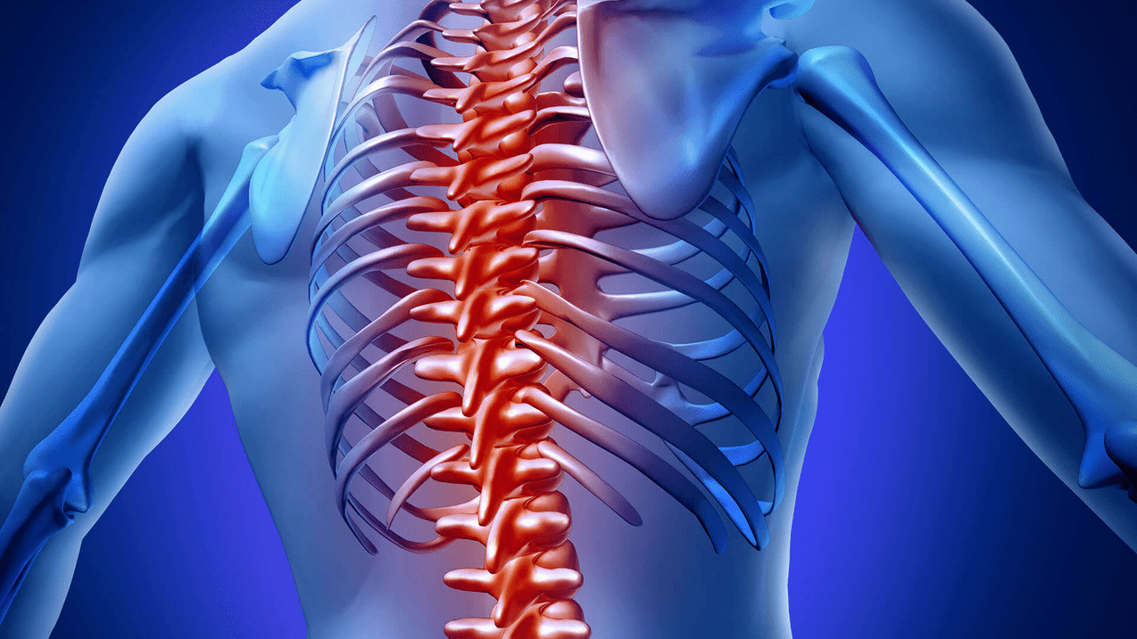 osteohondroza torakalne hrbtenice