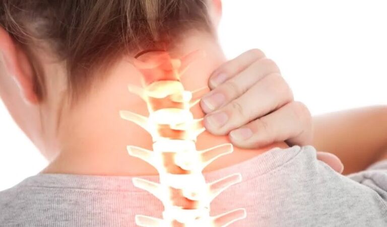 Osteohondroza 1. stopnje