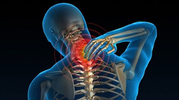 Bolečina pri obračanju vratu lahko kaže na vretenčni sindrom cervikalne osteohondroze