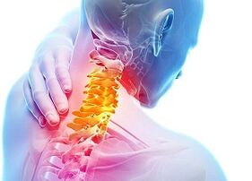 Vzroki za osteohondrozo materničnega vratu